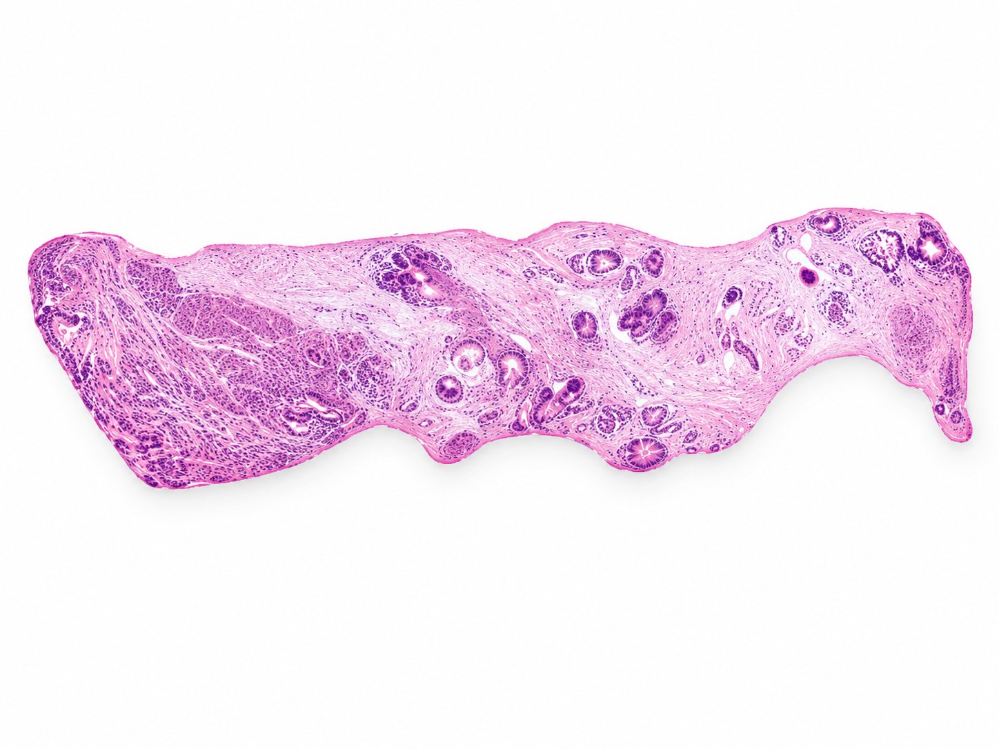 Digital image of fresh prostate biopsy tissue