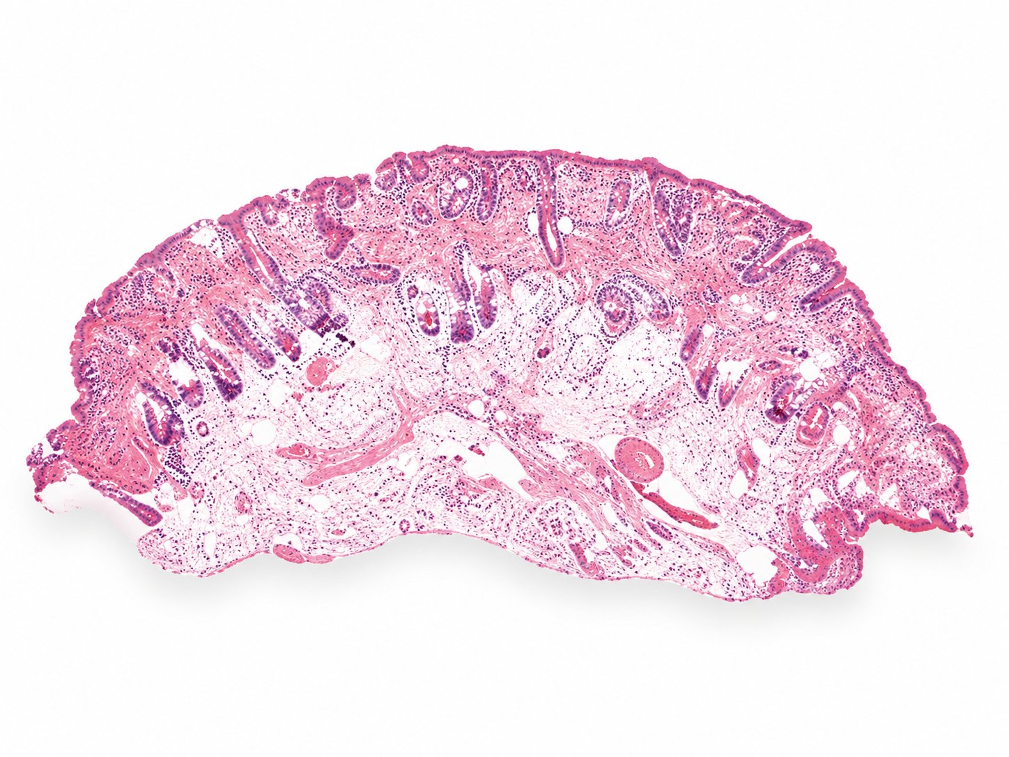 Digital image of fresh skin tissue
